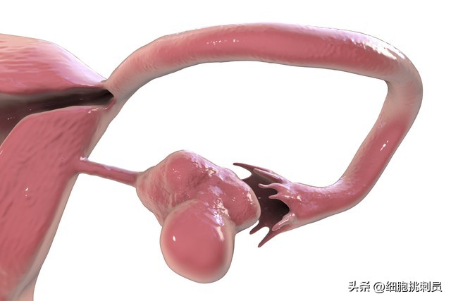 多囊卵巢综合症pcos诊断标准,多囊卵巢综合征pcos的近期治疗