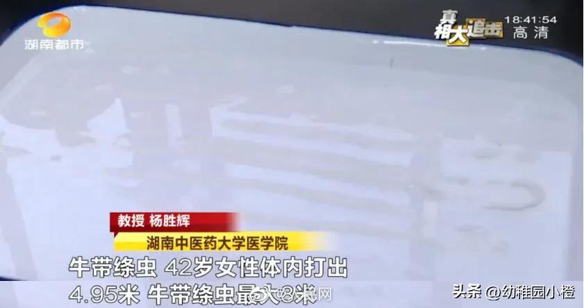 女子体内排出4米长绦虫是什么,宁德女子体内排出4米长绦虫