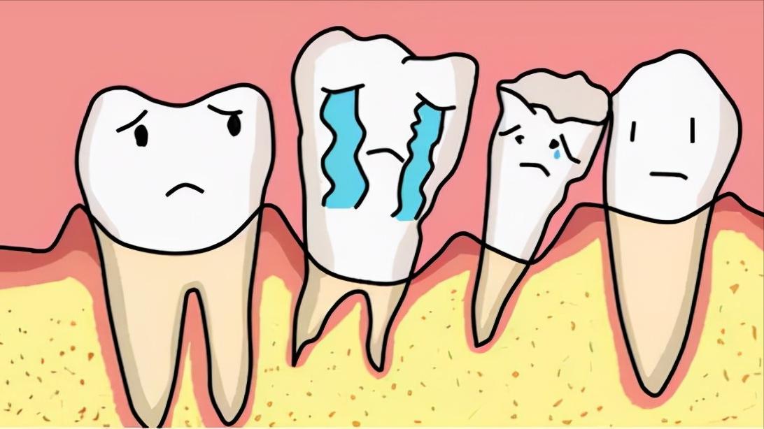 牙缝里的牙结石，如何清除干净？医生：3个办法是不少人的选择