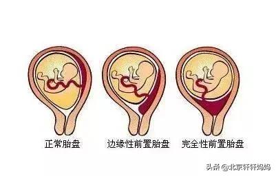 亲爱的小孩狗血片段,亲爱的小孩电视剧狗血