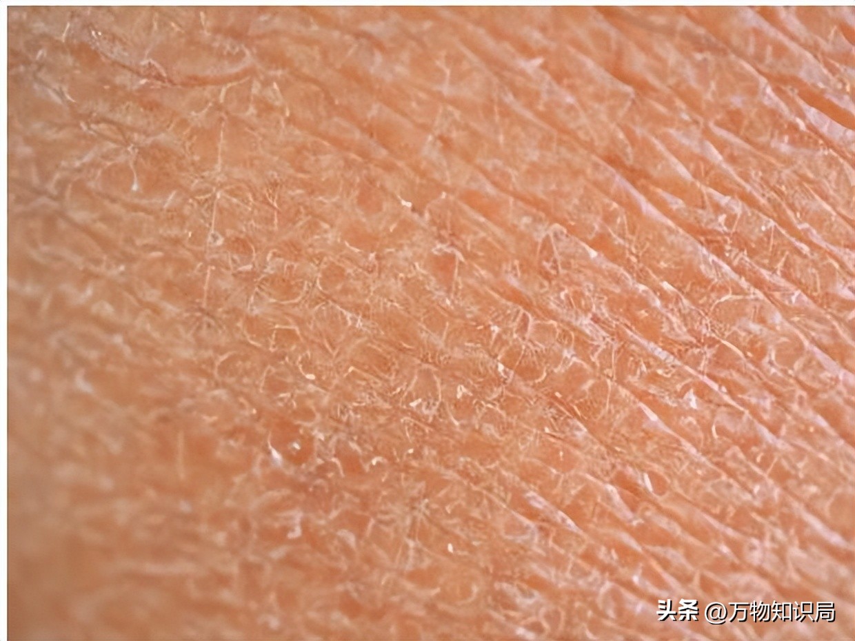 北方搓澡泥搓下来的真的是污垢吗,为什么搓澡会搓出泥来