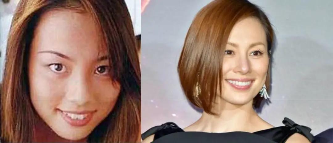 日本整牙的明星,日本整牙明星