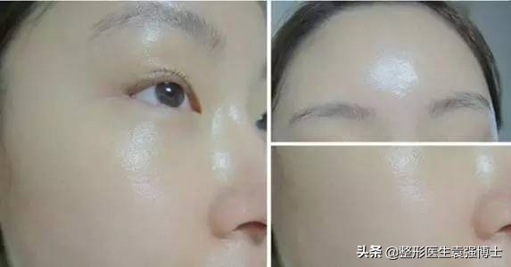 40岁以后要选择什么样的医美项目,40岁医美行业能干什么