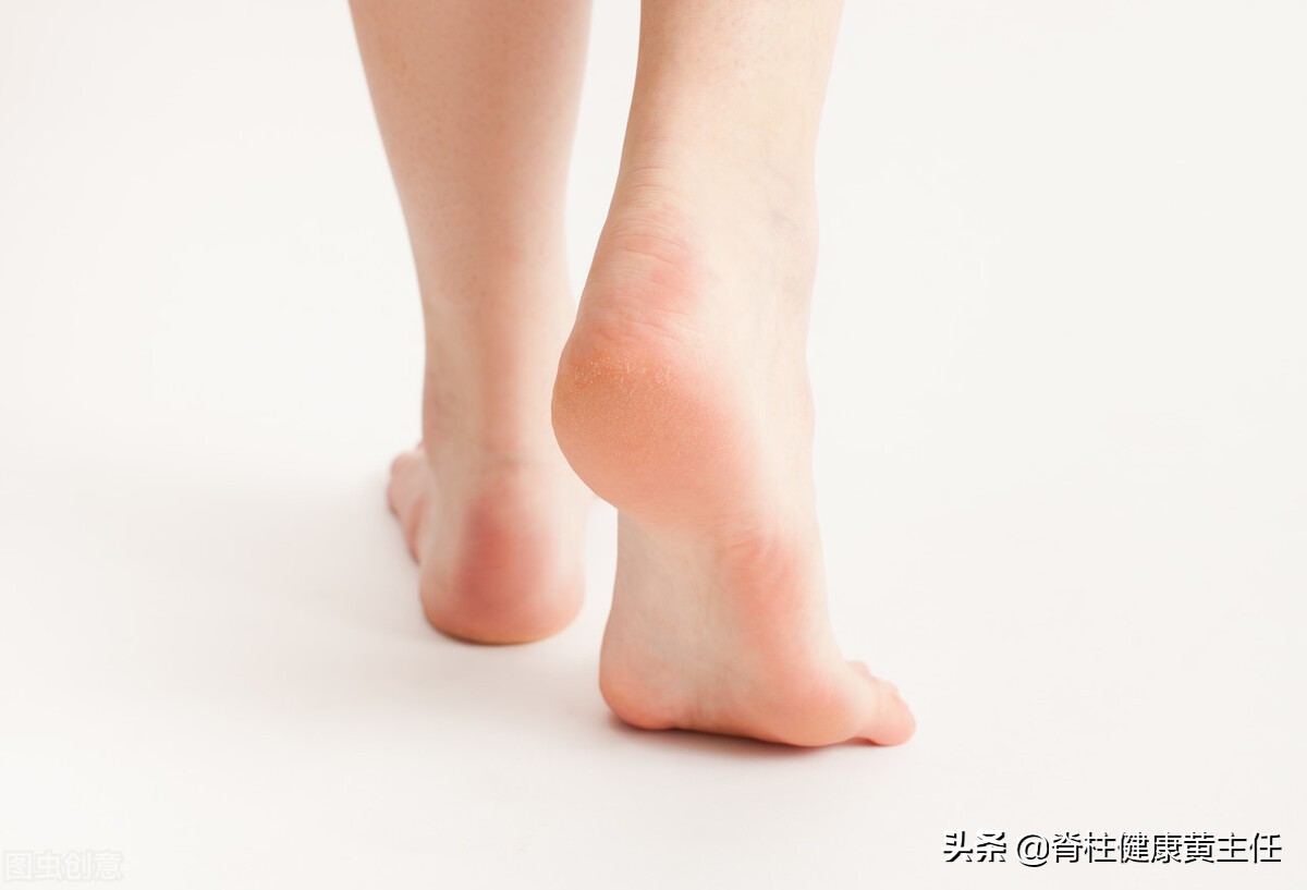 怎样判断自己有没有扁平足,怎么判断自己扁平足严不严重