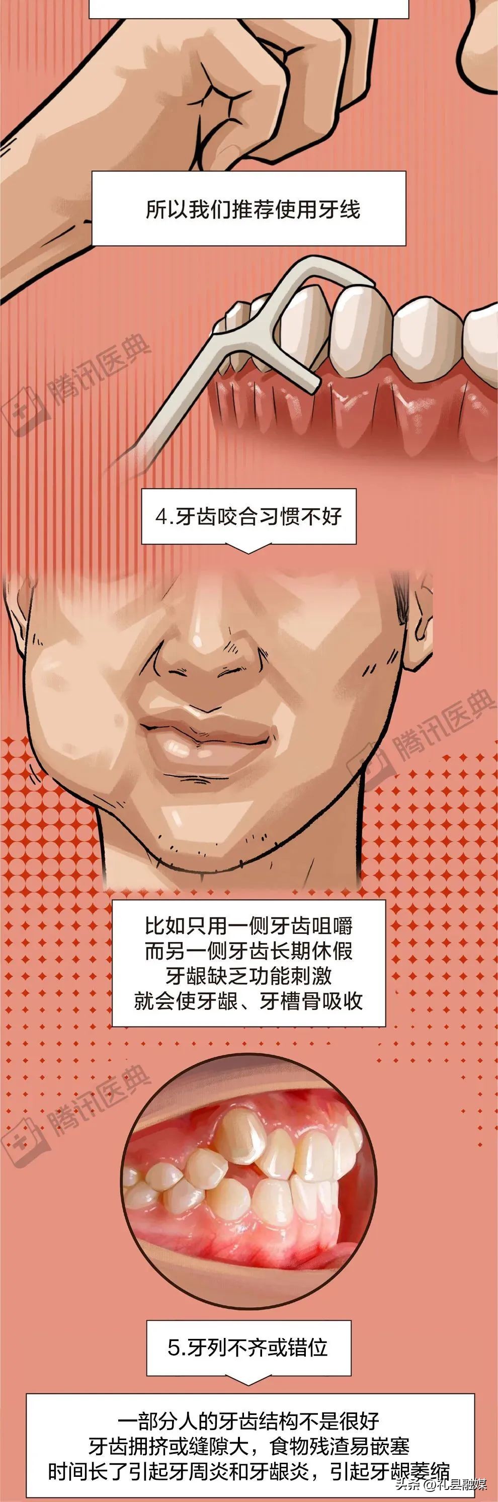 牙齿吃肉总是塞牙怎么治疗,吃肉吃菜老是塞牙怎么办