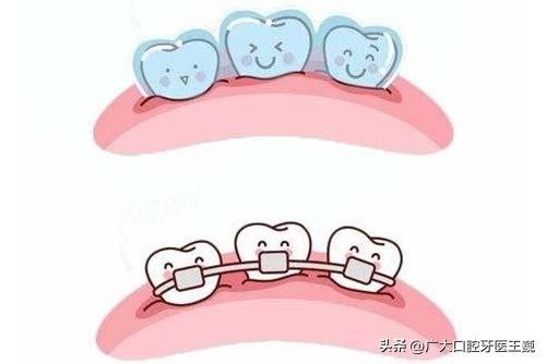 矫正牙齿戴牙套感觉疼痛怎么缓解,牙齿矫正戴牙套牙疼怎么解决