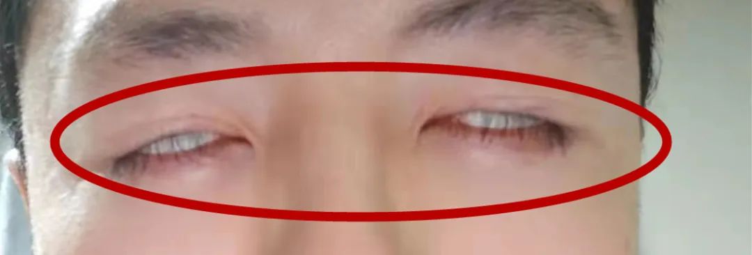 南京施尔美去疤痕,无锡施尔美整形祛疤痕