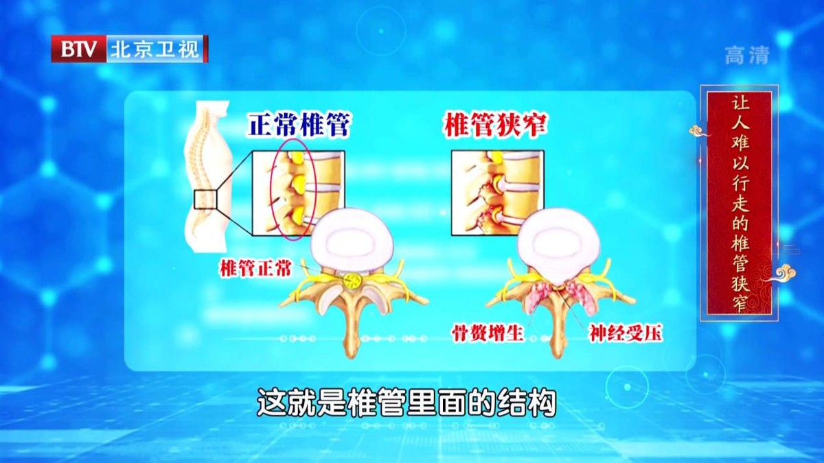 腰痛脊柱痛的最好解决办法,如何一个动作解决腰酸背痛