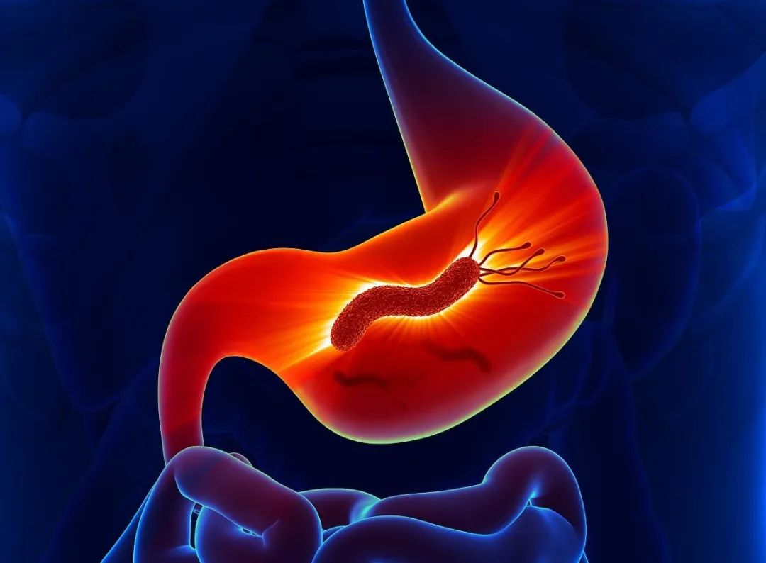 关于幽门螺杆菌（HP）的八条建议