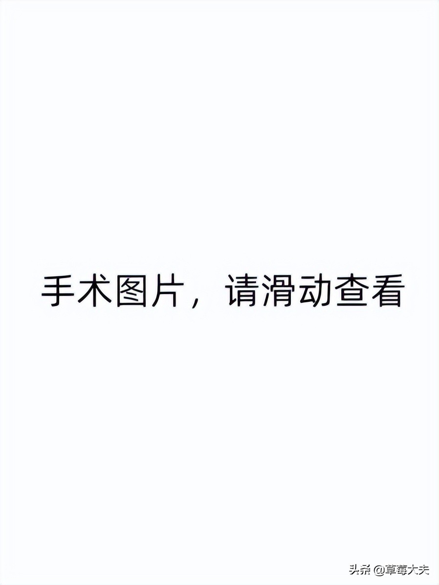 肚子莫名长大！40岁姐姐取出柚子大肿瘤，一查是肠道癌症跑到卵巢