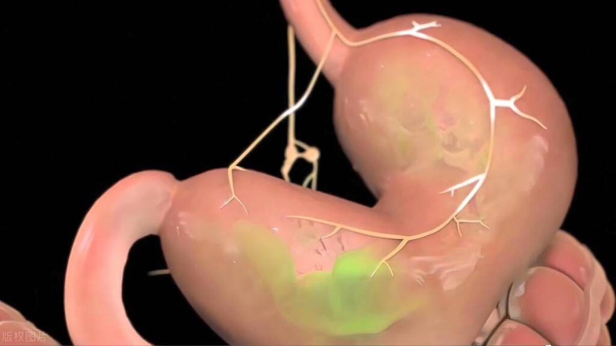 吃饭后马上喝中药有什么影响,吃饭后马上吃药会有怎样的危害