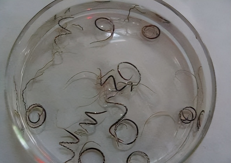 10岁孩子总头疼，发现是大脑异常？医生提醒：小孩别玩非洲大蜗牛