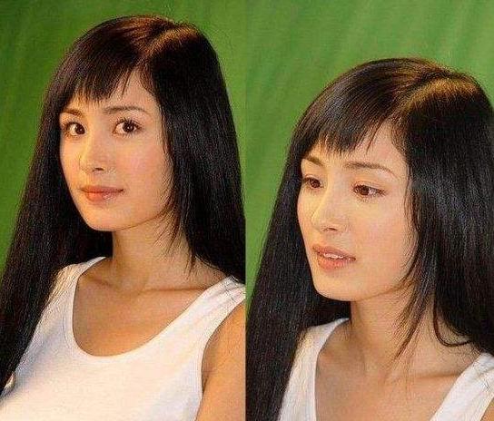 盘点整容失败惨不忍睹的30位女星,那些整容整失败的女明星