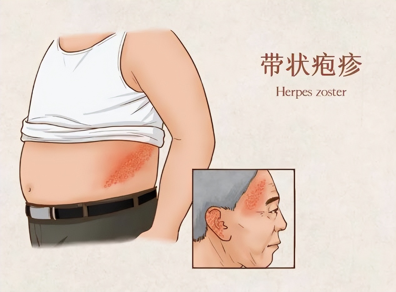 甲钴胺是什么药品治疗什么的,甲钴胺治疗神经每天吃几片最好