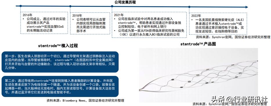 脑机接口发展现状及展望,脑机接口公司靠什么盈利