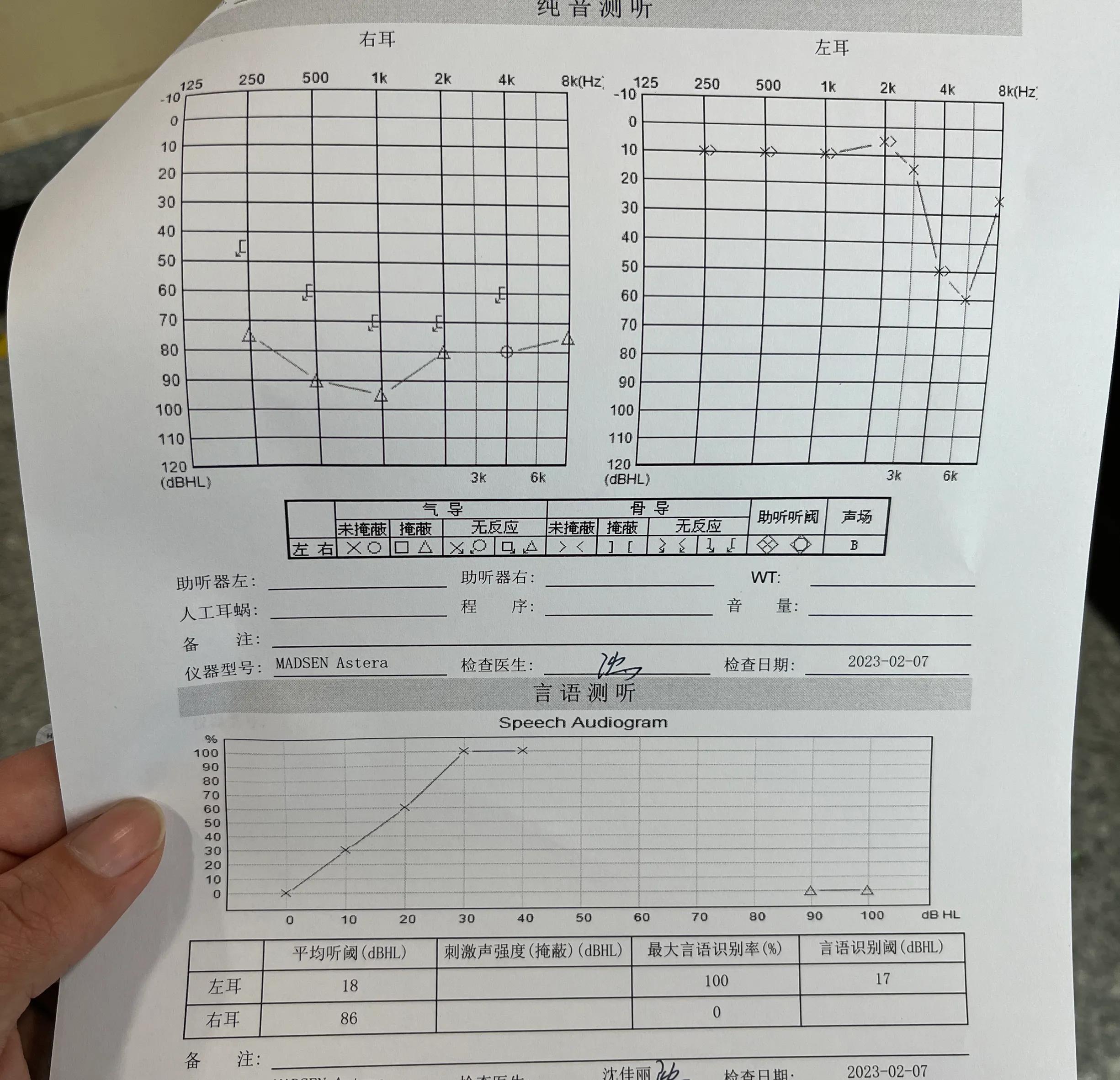 突发性耳聋的最新康复治疗方法,突发性耳聋的最佳疗法中医
