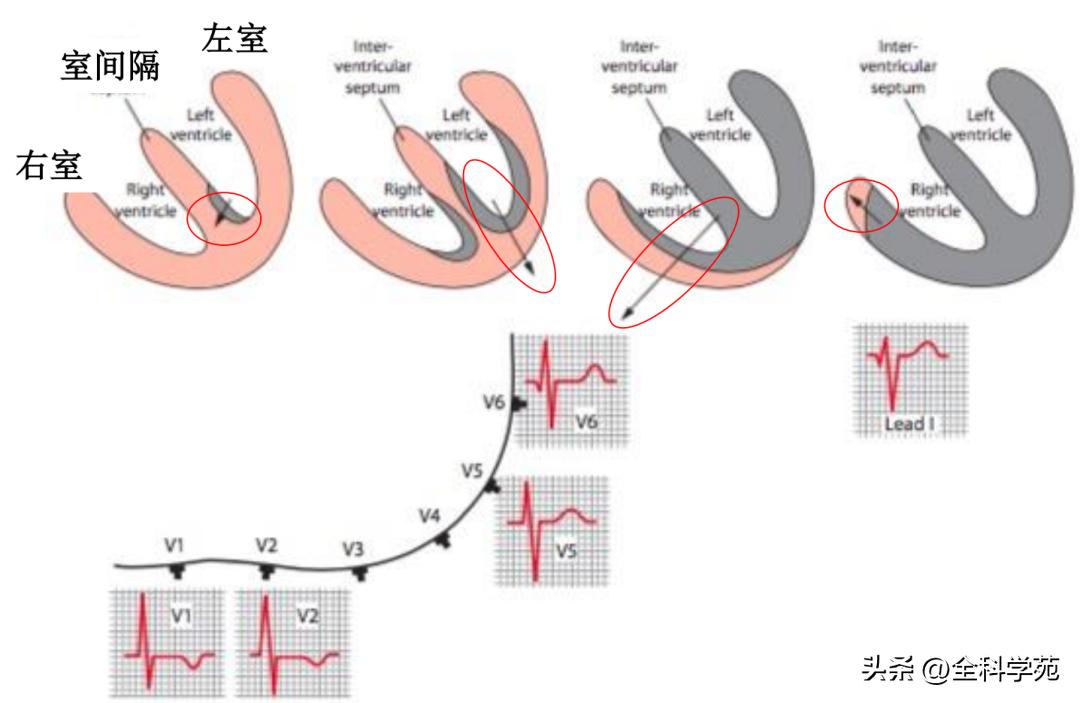 心电图qrs间期变长是怎样造成的,心电图qrs振幅多少是正常范围