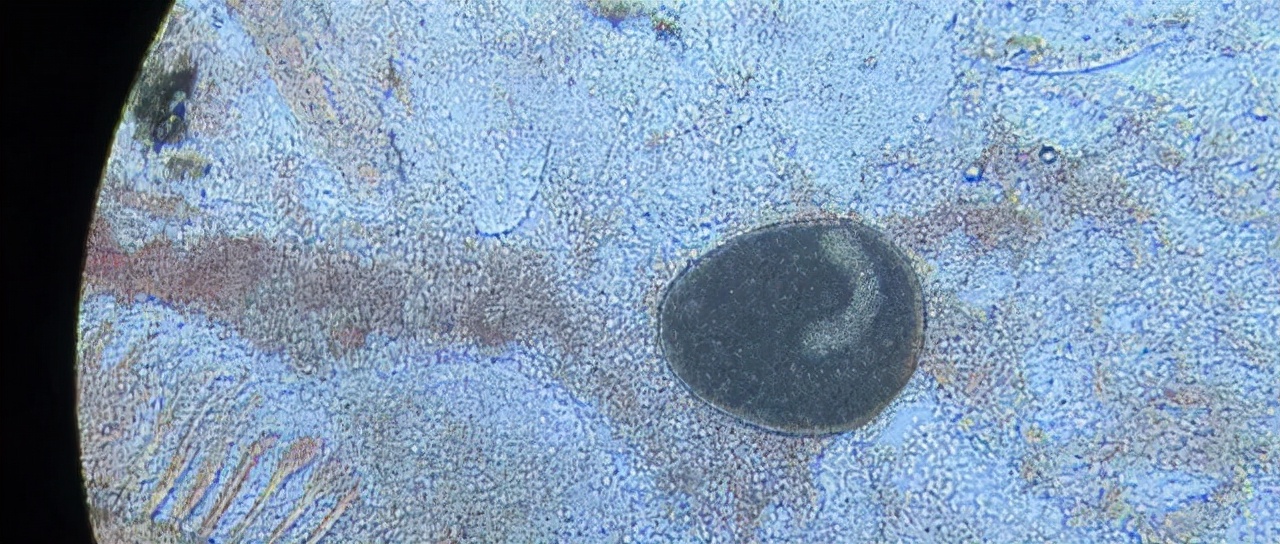 小瓜虫爆发如何快速处理,小瓜虫最好的克星