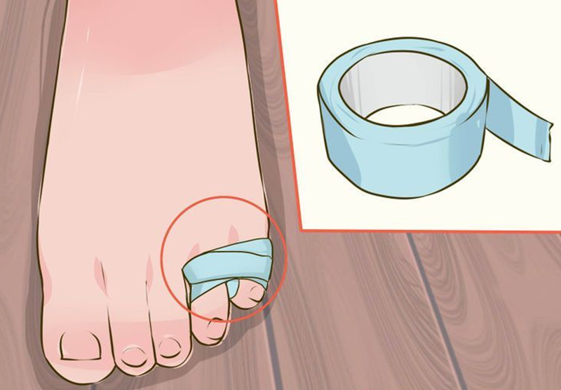 手指骨折和脚踝骨折哪个难受,手腕骨折和脚踝骨折哪个严重