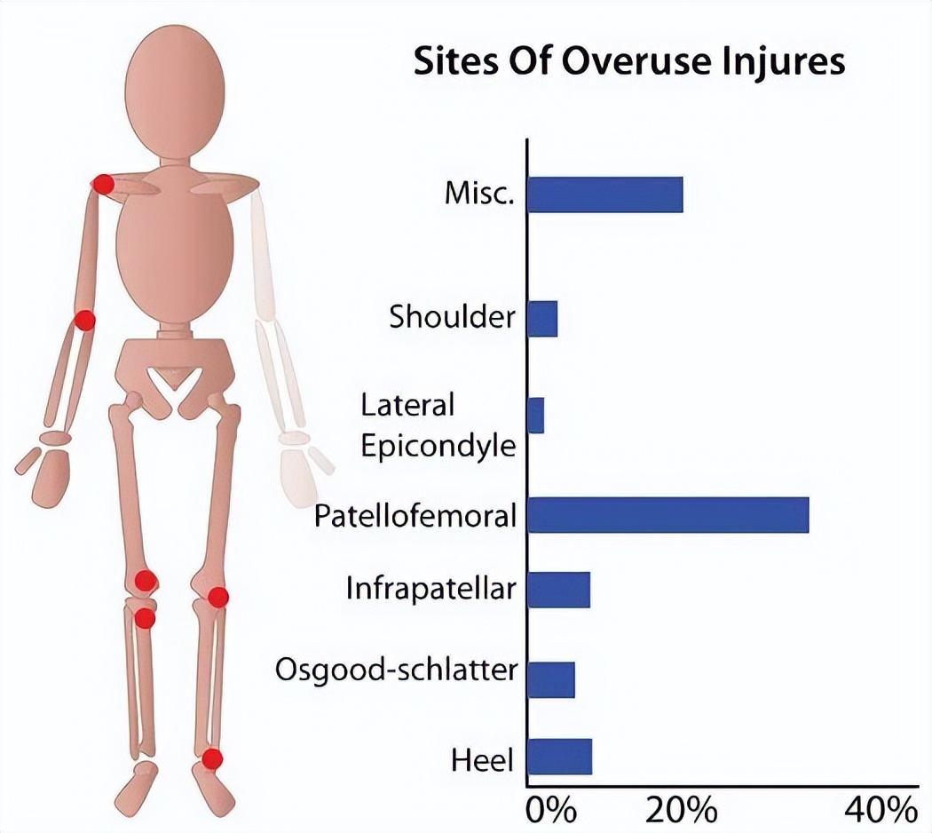 这种损伤，越是重复性的运动，风险越大