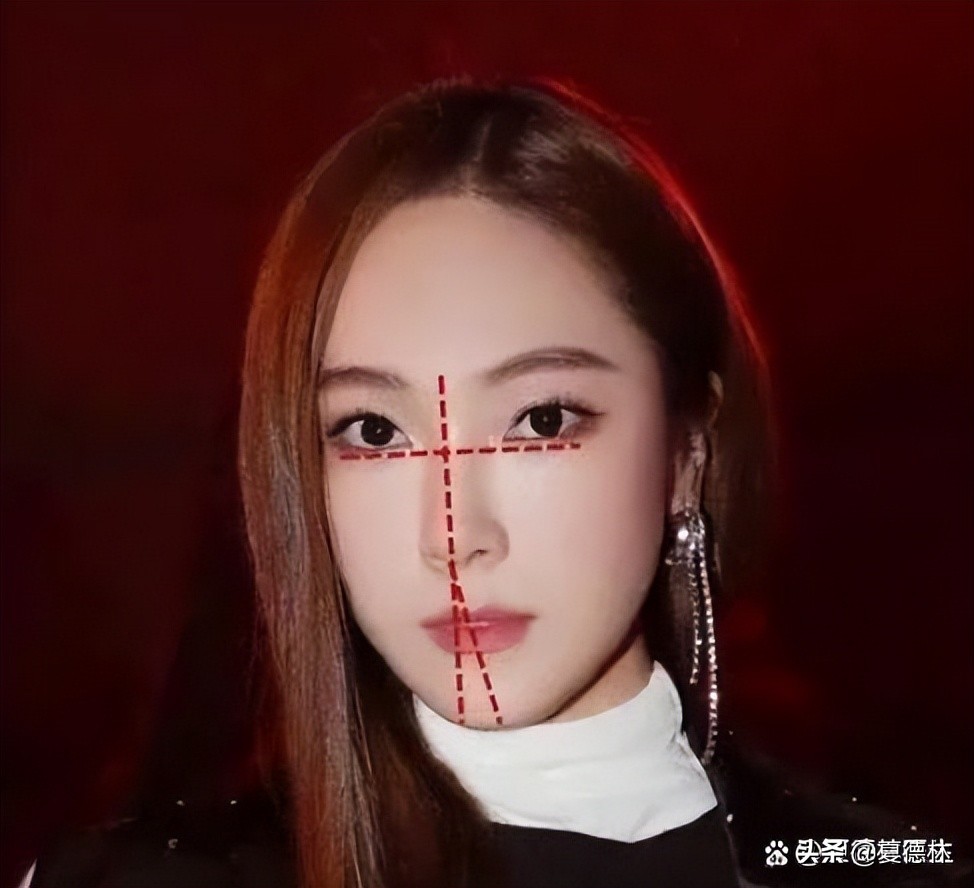 歪脸越来越严重怎么办,偏颌歪脸成人怎么改善