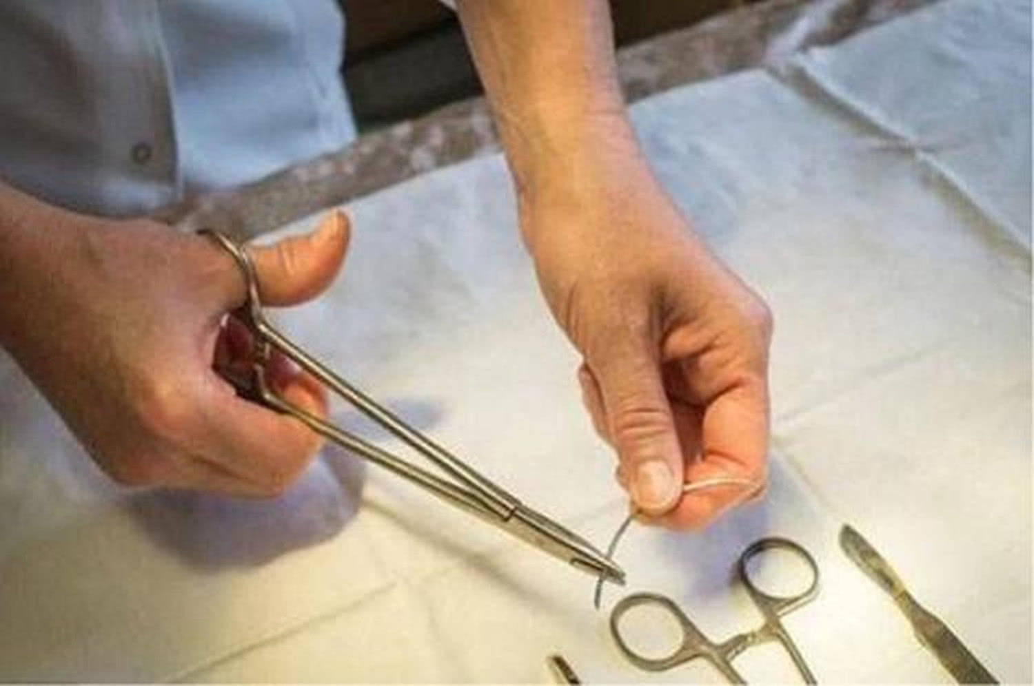 节育环一直不取有什么危害,节育环一直不取绝经后出血