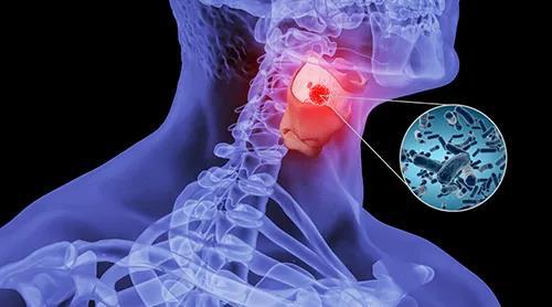 为什么慢性支气管炎反复发作,慢性支气管炎为什么反反复复发作