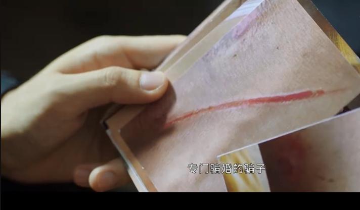 女子被竹签刺穿,22岁女子被刺穿