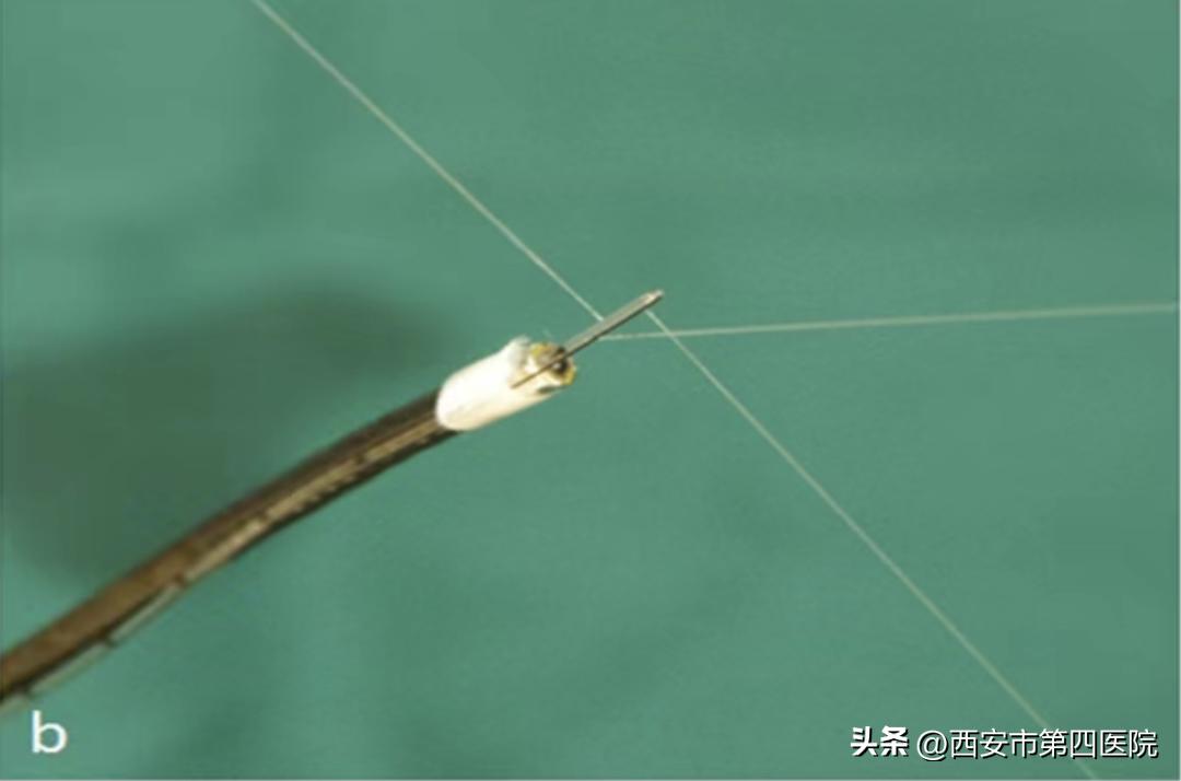 健康中国行动2030图解,健康中国行动合理标准