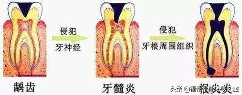 牙齿长黑线？你的牙危险了！教你怎么补救