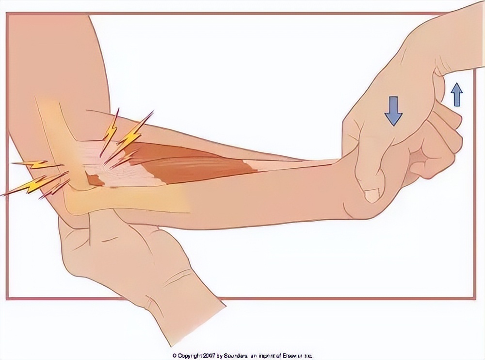 在做冲击波治疗前可以打封闭吗,冲击波治疗网球肘有效吗