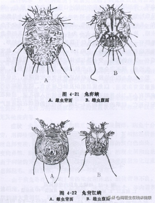 疥螨虫病怎么引起的,疥螨感染是什么意思