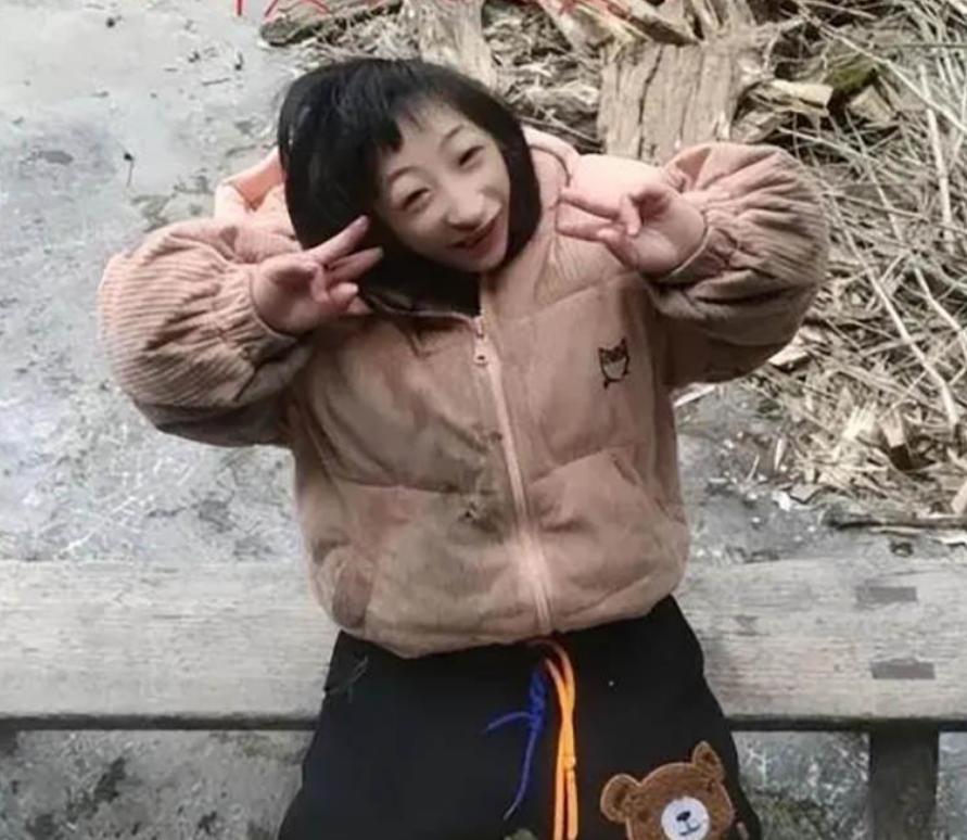 湖南一产妇生下“小猴子”,湖南产妇生下猴女孩上节目