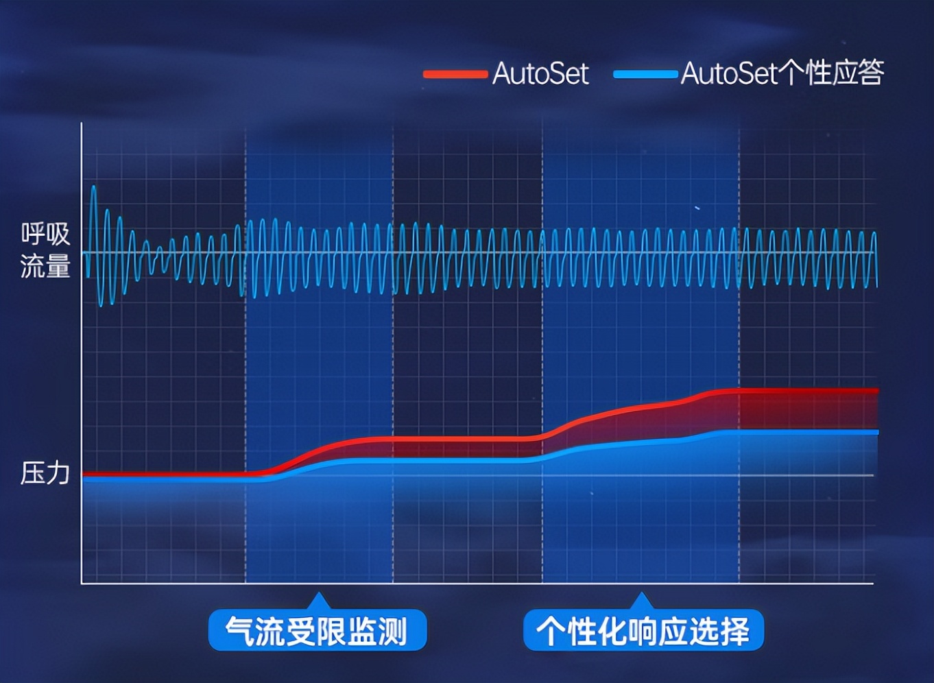瑞思迈s10单水平和双水平区别,瑞思迈s10双水平价格