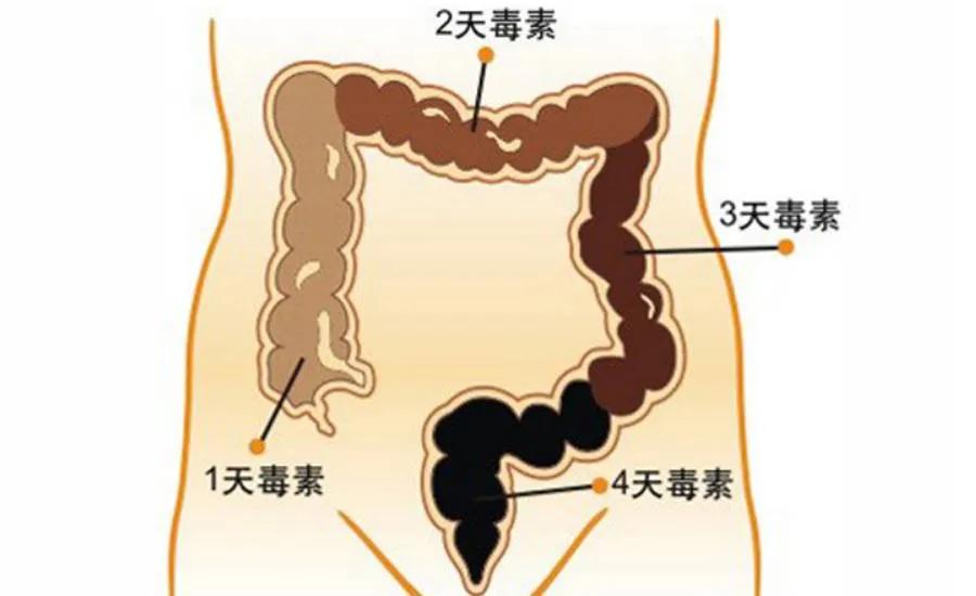 肠长了息肉会有啥症状,肠内为什么容易长息肉