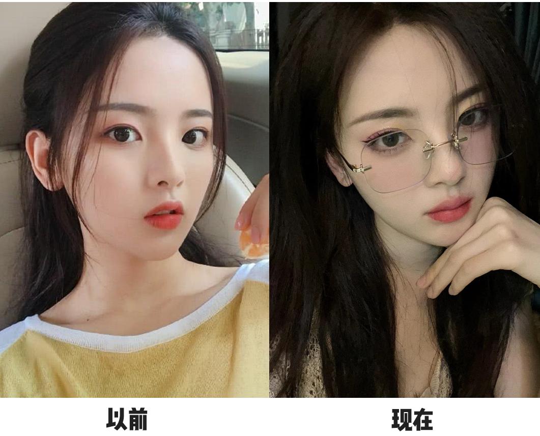 杨超越整过容吗,杨超越有没有整过容