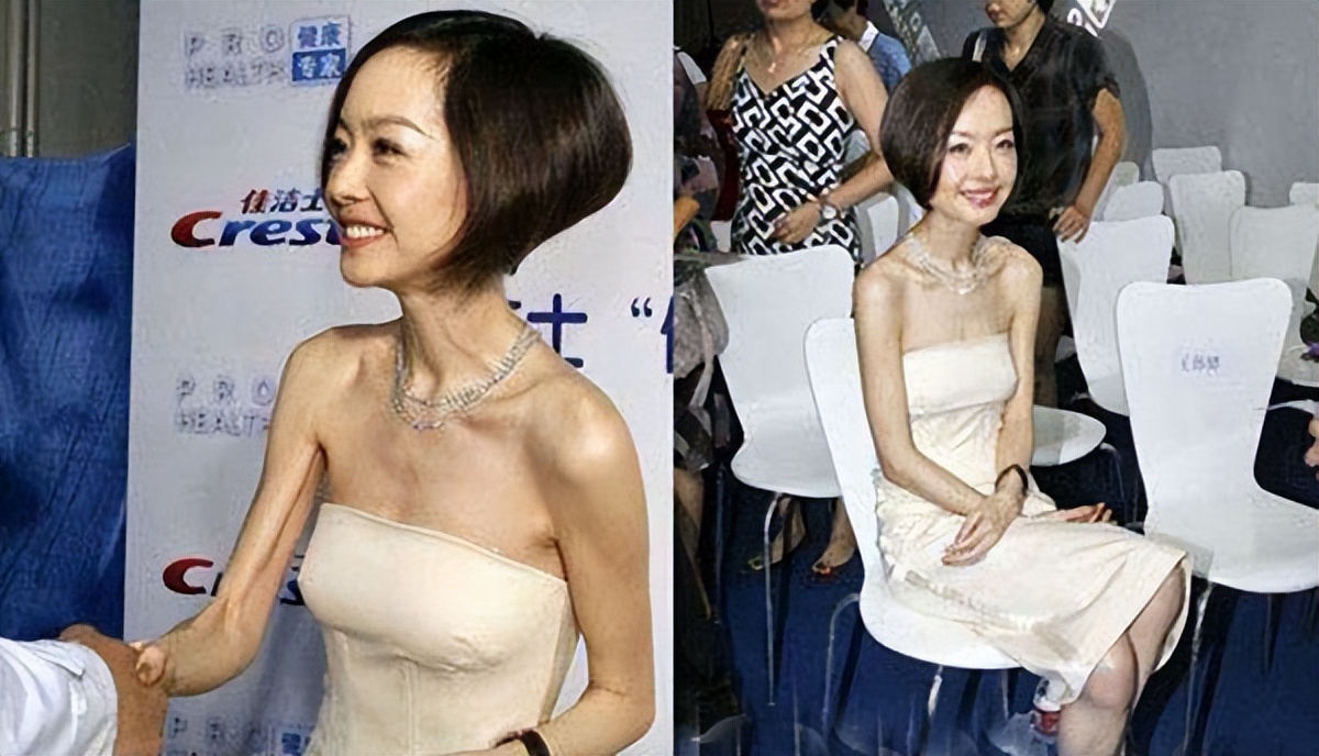 瘦到脸部凹陷到底好不好看,瘦到五官凹陷