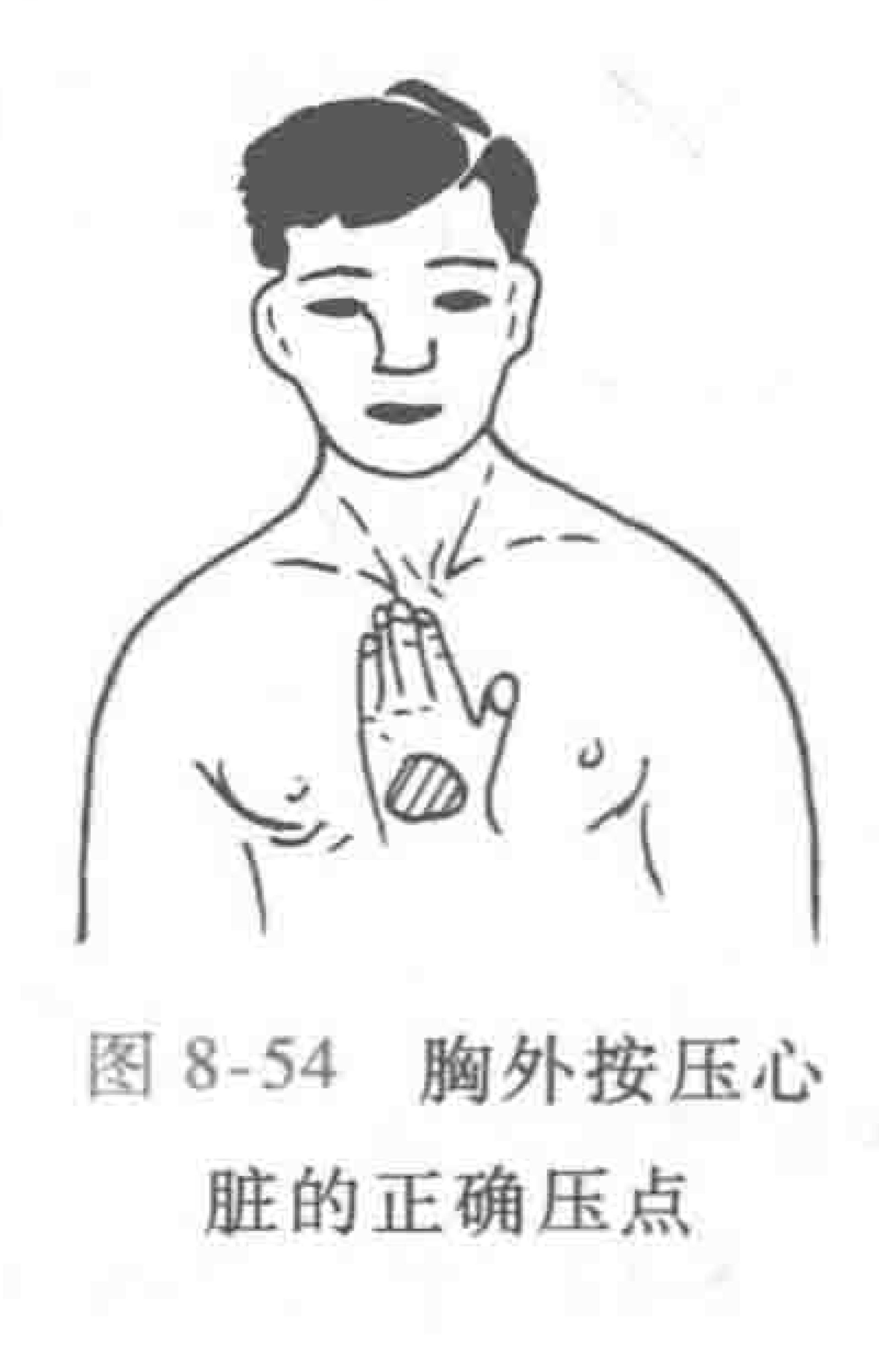 触电的急救处理有什么方法,触电的急救处理