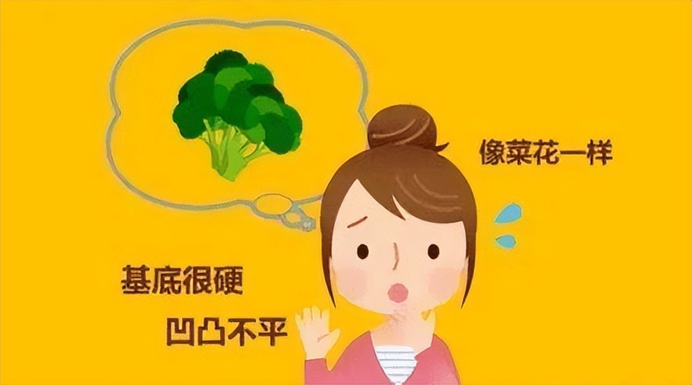 怀疑自己得了性病需要做什么检查