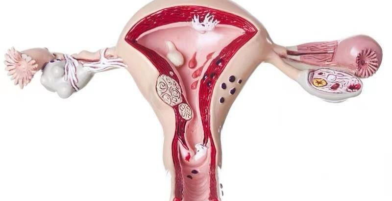 女性使用的避孕措施,避孕措施安全套