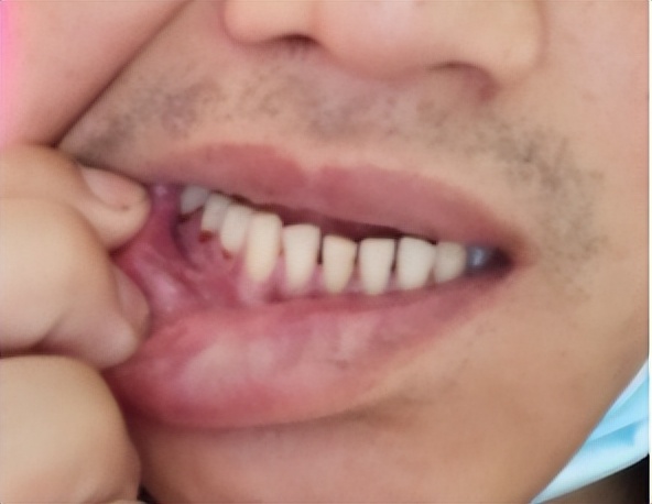 黄贵生：拉筋，为什么可以改善抑郁症？拉筋的同时要注意养肝