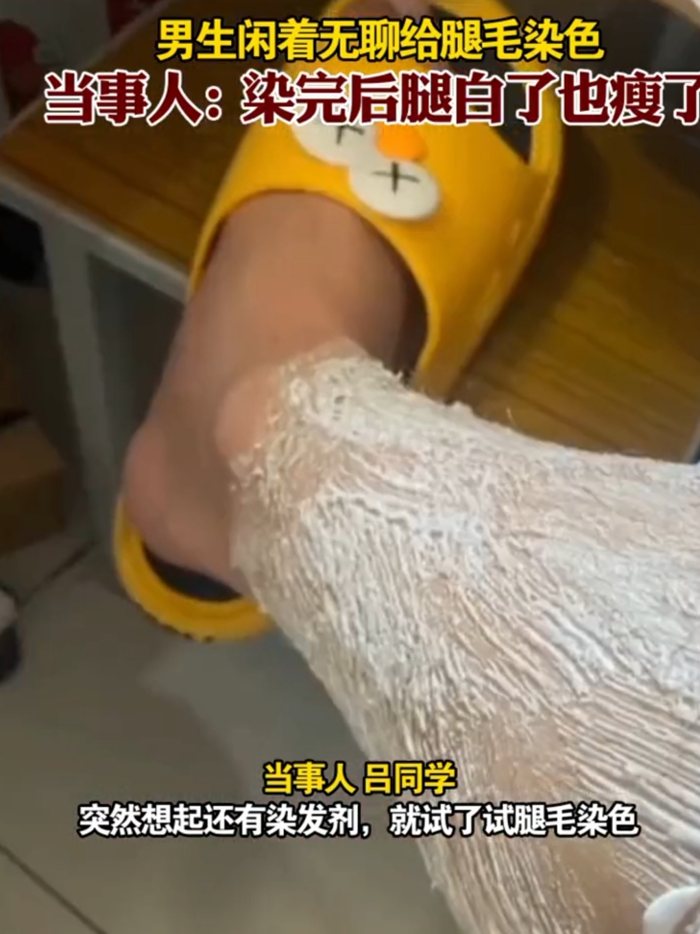 腿毛染什么颜色显白,男大学生上网课