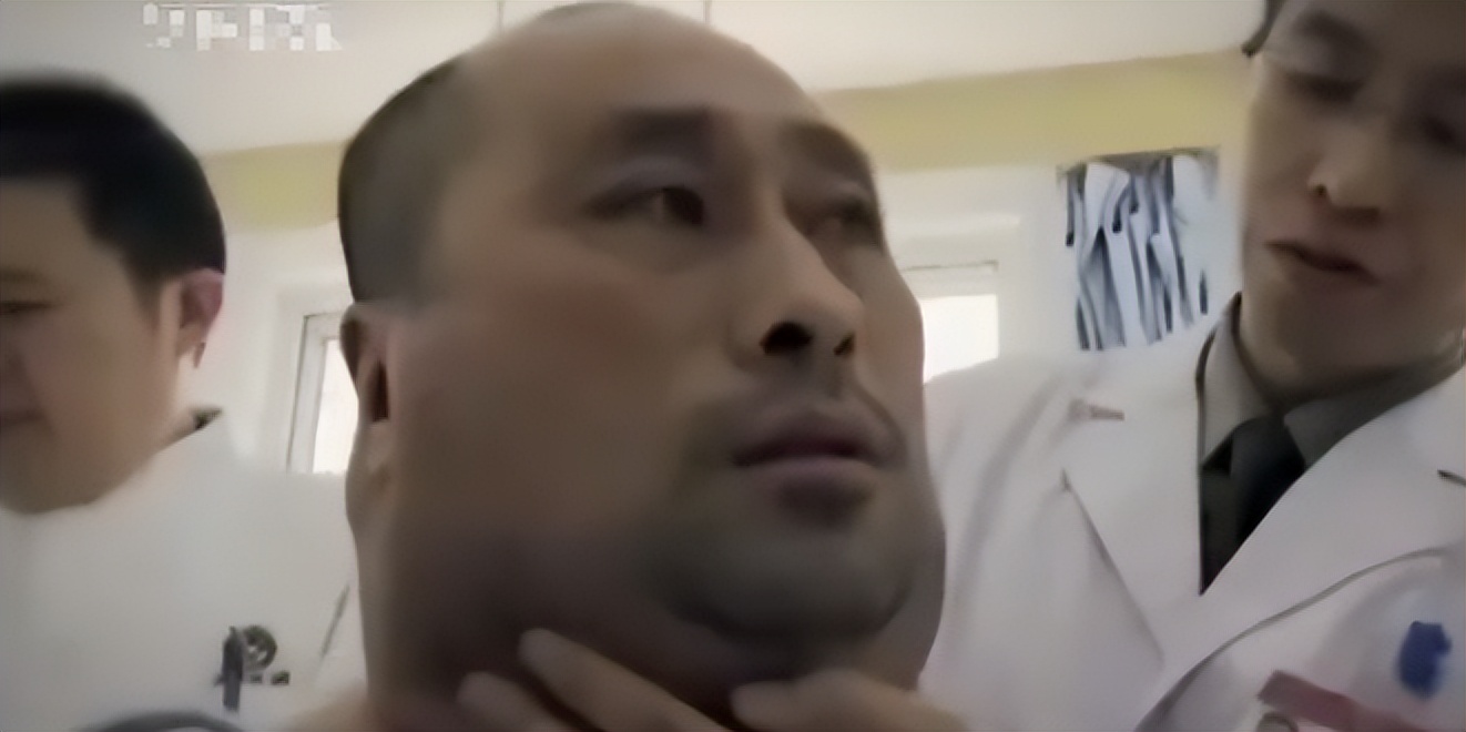 辽宁男子喝3万斤酒撑大脖子,男子嗜酒如命一天三四斤白酒