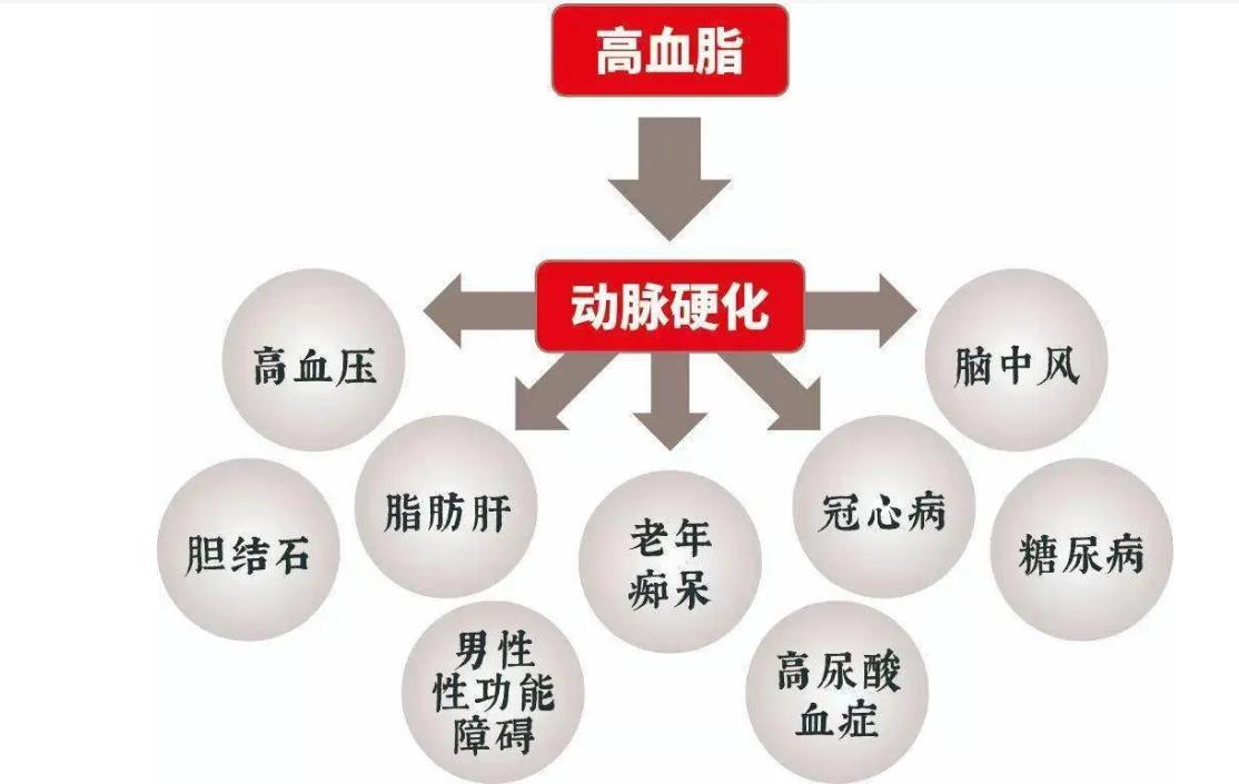 降血脂可以预防脑梗吗,降血脂会不会预防脑梗