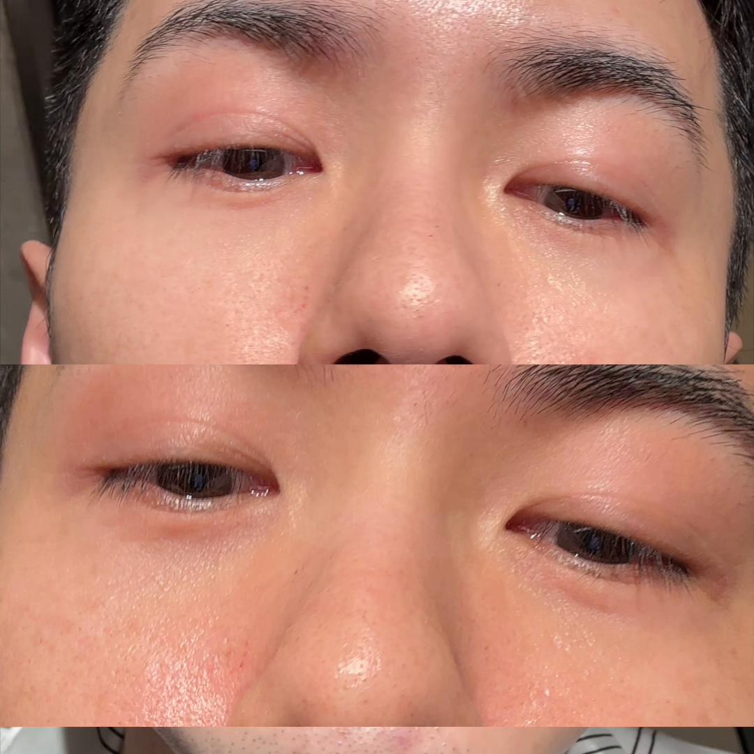 咖啡渣消眼圈，帮大家试过了。#618