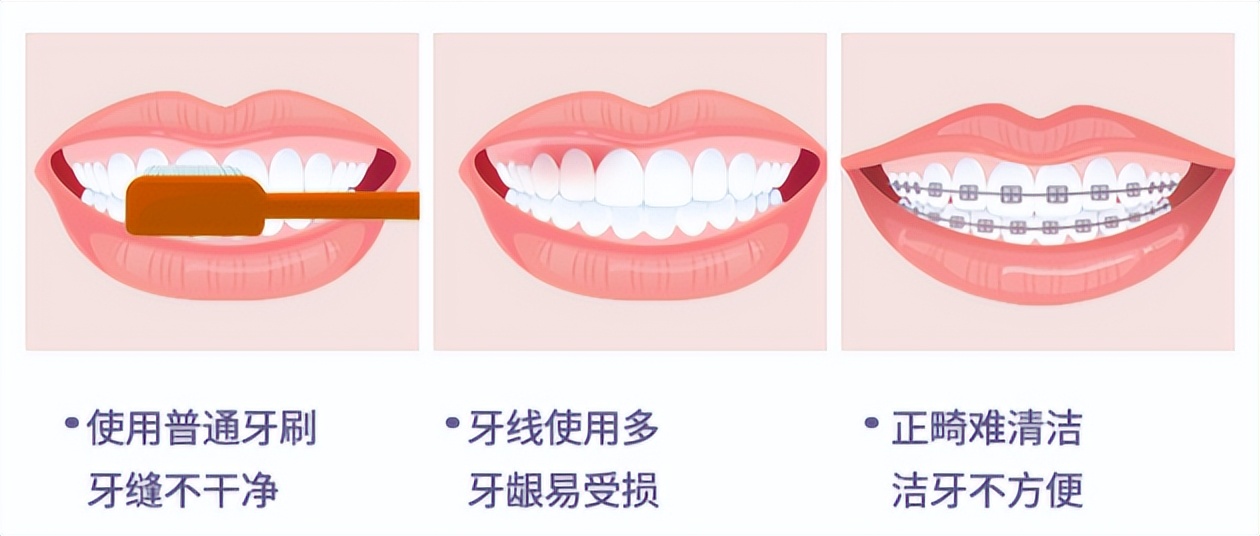 水冲牙器的危害,水牙线冲牙器的危害