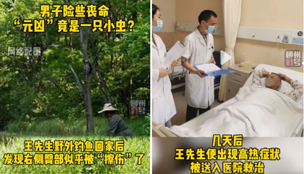 恙虫到底有多可怕？致死率极高