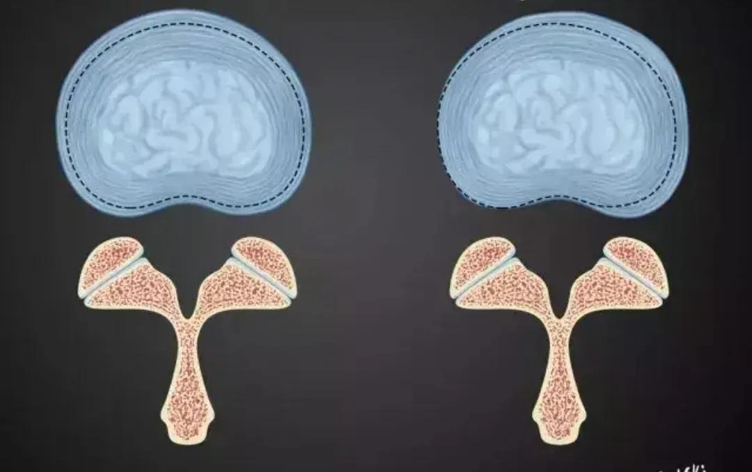 腰椎间盘突出保守治疗医生不开药,腰椎间盘突出专家讲解怎样治好