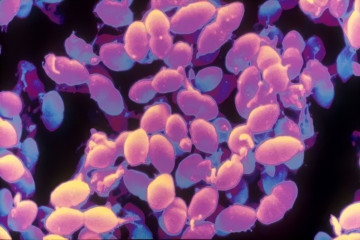 细菌培养结果显示大肠埃希菌,葡萄球菌大肠埃希菌菌落