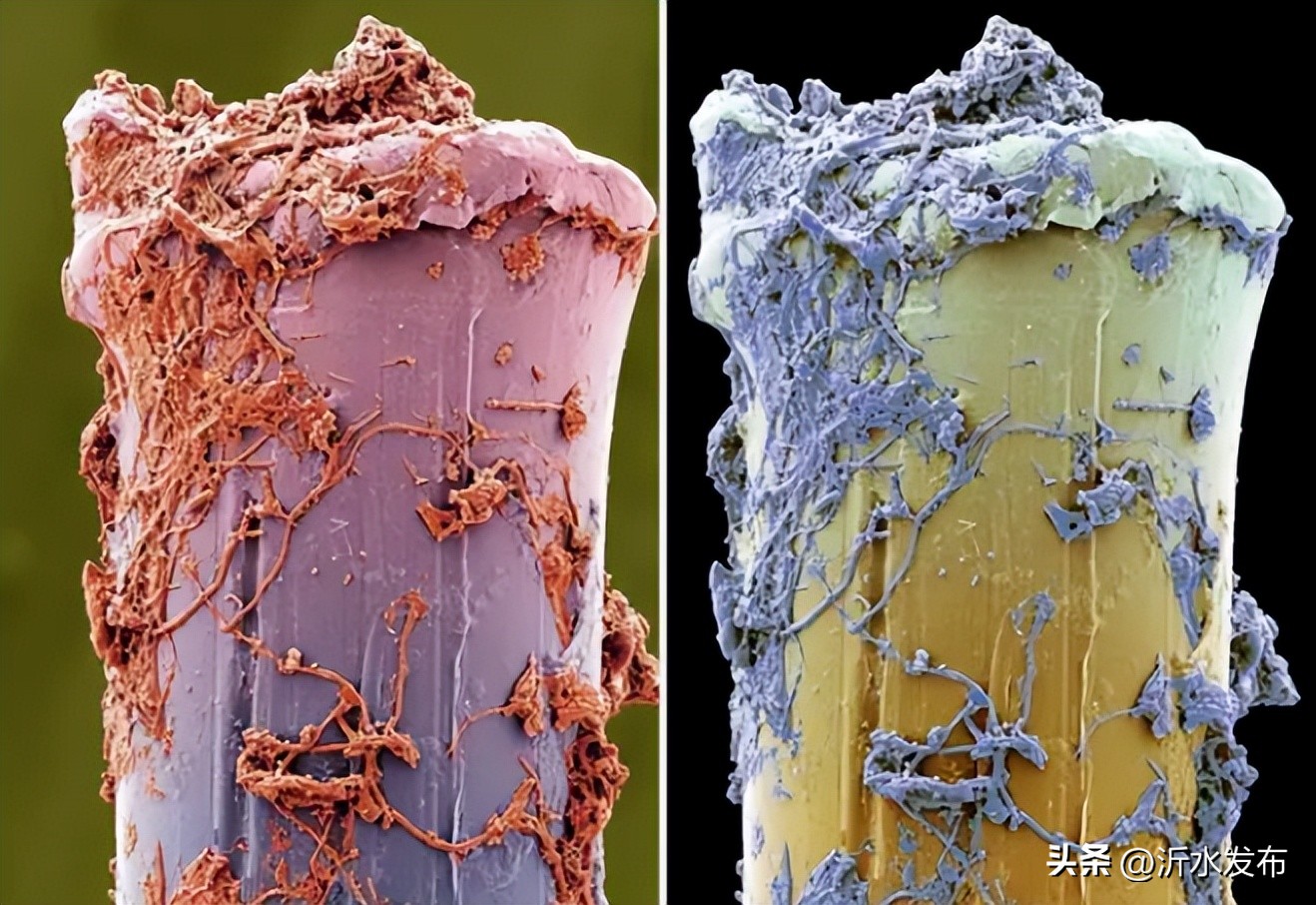 牙齿上黑色的斑点可以洗干净吗,牙齿牙渍斑很黄刷牙能去掉吗